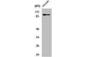 Western Blot analysis of Jurkat cells using DDX54 Polyclonal Antibody (DDX54 anticorps  (Internal Region))