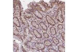 Immunohistochemical staining of human stomach with C9orf167 polyclonal antibody  shows moderate cytoplasmic positivity in glandular cells at 1:10-1:20 dilution. (TOR4A anticorps)