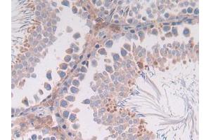 IHC-P analysis of Rat Intestine Tissue, with DAB staining. (IL-4 anticorps  (AA 61-111))