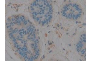 Detection of C3 in Human Mammary gland Tissue using Polyclonal Antibody to Complement Component 3 (C3)