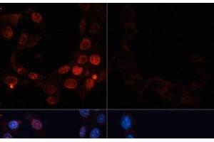 Immunofluorescence analysis of NIH/3T3 cells using Phospho-γH2A. (gamma H2AX anticorps  (pSer139))