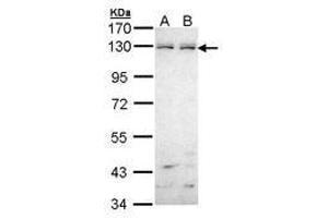 Image no. 1 for anti-EPH Receptor B6 (EPHB6) (AA 793-977) antibody (ABIN467545) (EPH Receptor B6 anticorps  (AA 793-977))