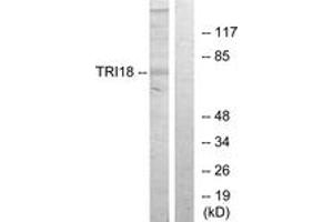 Western blot analysis of extracts from 293 cells, using TRI18 Antibody. (MID1 anticorps  (AA 71-120))