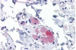 Human Small Intestine, submucosal plexus: Formalin-Fixed, Paraffin-Embedded (FFPE)
