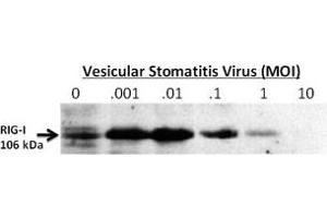 24-hour post infection immunoblots of whole cell lysates from primary murine microglia cells (2x106) untreated (0) or exposed to vesicular stomatitis virus at a range of viral particle/cell ratios. (DDX58 anticorps  (C-Term))