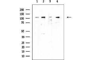 anti-EPH Receptor B4 (EPHB4) (Internal Region) antibody