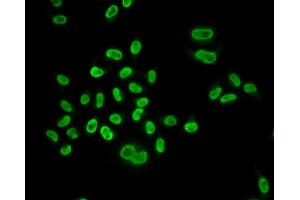 Immunofluorescence analysis of U2OS cells using MCM6 antibody. (MCM6 anticorps)