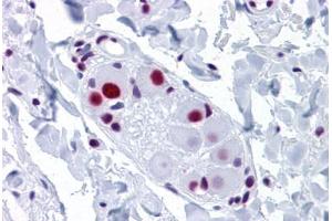 anti-Small Nuclear Ribonucleoprotein Polypeptide A (SNRPA) (AA 1-283) antibody