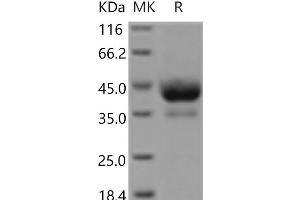Western Blotting (WB) image for Activin A Receptor, Type IB (ACVR1B) (Active) protein (Fc Tag) (ABIN7321211)