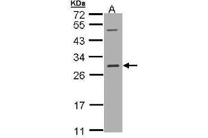 WB Image Sample (30 ug of whole cell lysate) A: Hep G2 , 12% SDS PAGE antibody diluted at 1:1000 (RALB anticorps  (full length))
