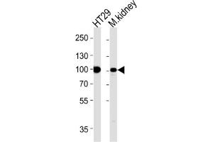 Western Blotting (WB) image for anti-Villin 1 (VIL1) antibody (ABIN3002792) (Villin 1 anticorps)