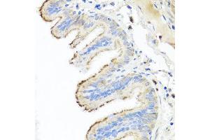 Immunohistochemistry of paraffin-embedded human trachea using IL10 antibody at dilution of 1:100 (x40 lens). (IL-10 anticorps)