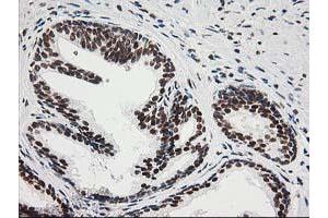 Image no. 12 for anti-Excision Repair Cross-Complementing Rodent Repair Deficiency, Complementation Group 4 (ERCC4) antibody (ABIN1498070)