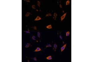 Immunofluorescence analysis of L929 cells using SEMA antibody (ABIN7270199) at dilution of 1:100.