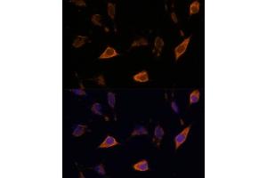 Immunofluorescence analysis of L929 cells using SEMA antibody (ABIN7270199) at dilution of 1:100. (Sema4a anticorps  (AA 320-580))