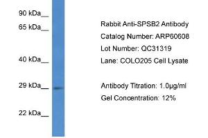 Western Blotting (WB) image for anti-SplA/ryanodine Receptor Domain and SOCS Box Containing 2 (SPSB2) (C-Term) antibody (ABIN786218) (SPSB2 anticorps  (C-Term))