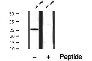 Western blot analysis of extracts from rat lung, using BCA3 Antibody. (AKIP1 anticorps  (Internal Region))