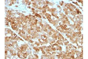 Image no. 1 for anti-Tyrosinase (TYR) antibody (ABIN6189763) (TYR anticorps)