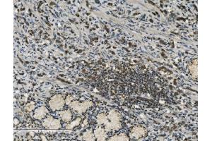 IHC analysis of PARP using anti-PARP antibody (ABIN7602278). (PARP1 anticorps  (AA 670-858))