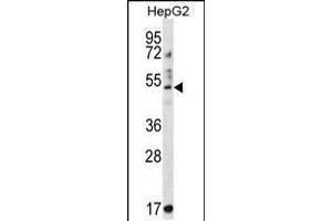 Western blot analysis in HepG2 cell line lysates (35ug/lane). (TRIM11 anticorps  (C-Term))
