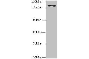 Western blot All lanes: MTHFD1L antibody at 3. (MTHFD1L anticorps  (AA 759-978))