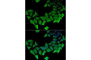 Immunofluorescence analysis of HeLa cells using APLP1 antibody (ABIN5975741).
