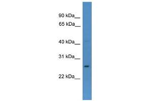 WB Suggested Anti-CDX1 Antibody Titration:  0. (CDX1 anticorps  (N-Term))
