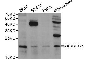Western blot analysis of extracts of various cell lines, using RARRES2 antibody (ABIN5974187) at 1/1000 dilution. (Chemerin anticorps)