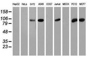 Image no. 4 for anti-phosphofructokinase, Platelet (PFKP) antibody (ABIN1500161)