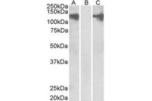 Image no. 1 for anti-Pumilio Homolog 2 (Drosophila) (PUM2) (Internal Region) antibody (ABIN374533) (PUM2 anticorps  (Internal Region))