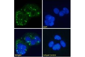 Immunofluorescence staining of fixed HepG2 cells with anti-Human Glucagon Receptor antibody hGR-2 F6. (Recombinant Glucagon Receptor anticorps)