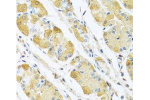 Immunohistochemistry of paraffin-embedded Human stomach using C4BPB Polyclonal Antibody at dilution of 1:100 (40x lens).