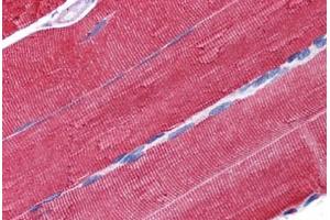 Human Skeletal Muscle: Formalin-Fixed, Paraffin-Embedded (FFPE)