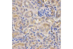 Immunohistochemistry of paraffin-embedded mouse kidney using CFB antibody at dilution of 1:200 (x400 lens) (Complement Factor B anticorps)