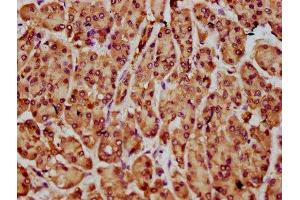 IHC image of ABIN7161327 diluted at 1:300 and staining in paraffin-embedded human pancreatic cancer performed on a Leica BondTM system. (NLN anticorps  (AA 109-241))