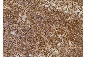 ABIN6277610 at 1/100 staining Mouse spleen tissue by IHC-P.