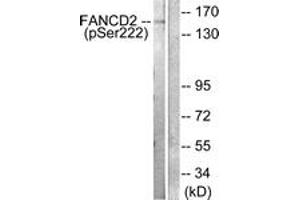 Western blot analysis of extracts from HT29 cells treated with Calyculin A 50ng/ml 30', using FANCD2 (Phospho-Ser222) Antibody.