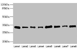 Western blot All lanes: PLP1 antibody at 4 μg/mL Lane 1: Hela whole cell lysate Lane 2: HL60 whole cell lysate Lane 3: K562 whole cell lysate Lane 4: THP-1 whole cell lysate Lane 5: U937 whole cell lysate Lane 6: A549 whole cell lysate Lane 7: Caco-2 whole cell lysate Lane 8: HepG2 whole cell lysate Secondary Goat polyclonal to rabbit IgG at 1/10000 dilution Predicted band size: 31, 27 kDa Observed band size: 31 kDa (PLP1 anticorps  (AA 143-197))