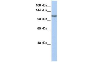 TGS1 antibody used at 1 ug/ml to detect target protein. (TGS1 anticorps)