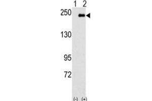 Western Blotting (WB) image for anti-Sperm Associated Antigen 9 (SPAG9) antibody (ABIN3003116) (SPAG9 anticorps)