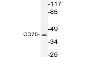Western blot (WB) analysis of CD75 antibody in extracts from RAW264. (ST6GAL1 anticorps)