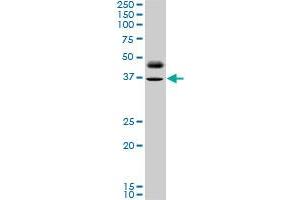 PAX8 monoclonal antibody (M10), clone 3G11.