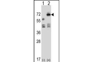 Western blot analysis of ARSF (arrow) using rabbit polyclonal ARSF Antibody (Center) (ABIN657171 and ABIN2846304). (ARSF anticorps  (AA 236-264))