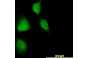 Immunofluorescence of monoclonal antibody to MAPKAPK2 on HeLa cell. (MAPKAP Kinase 2 anticorps  (AA 266-352))