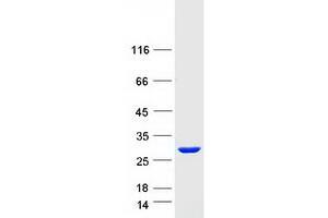 Validation with Western Blot