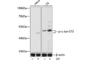 Western blot analysis of extracts of various cell lines, using Phospho-c-Jun-S73 antibody (ABIN3023567, ABIN3023568, ABIN3023569 and ABIN6225411) at 1:1000 dilution. (C-JUN anticorps  (pSer73))