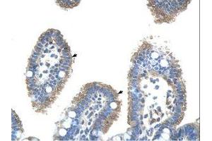 Image no. 1 for anti-Ubiquitin-Conjugating Enzyme E2, J2 (UBE2J2) (C-Term) antibody (ABIN203529)