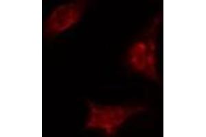ABIN6274367 staining A549 cells by IF/ICC. (TAF5 anticorps  (Internal Region))