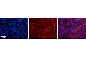 Rabbit Anti-AARS Antibody     Formalin Fixed Paraffin Embedded Tissue: Human Pineal Tissue  Observed Staining: Cytoplasmic in cell processes of pinealocytes  Primary Antibody Concentration: 1:100  Secondary Antibody: Donkey anti-Rabbit-Cy3  Secondary Antibody Concentration: 1:200  Magnification: 20X  Exposure Time: 0.