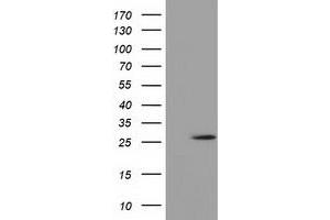Western Blotting (WB) image for anti-OTU Domain, Ubiquitin Aldehyde Binding 2 (OTUB2) antibody (ABIN1499936) (OTUB2 anticorps)
